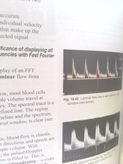 Understanding Ultrasound Physics (Rev Ed) by Edelman, Sidney K.
